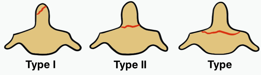 Anderson Classification