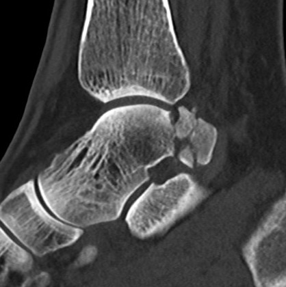 Posterior process