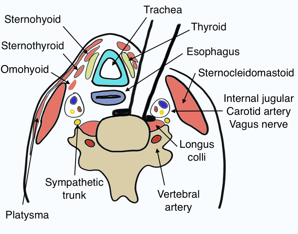 Anterior approach subaxial spine