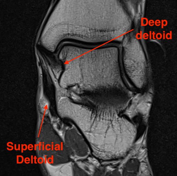 Deltoid