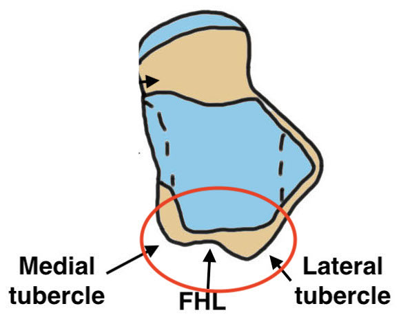 Posterior process